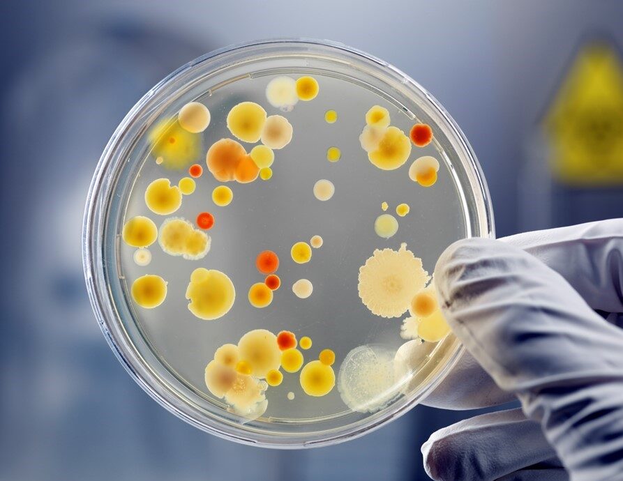Infection and Disease